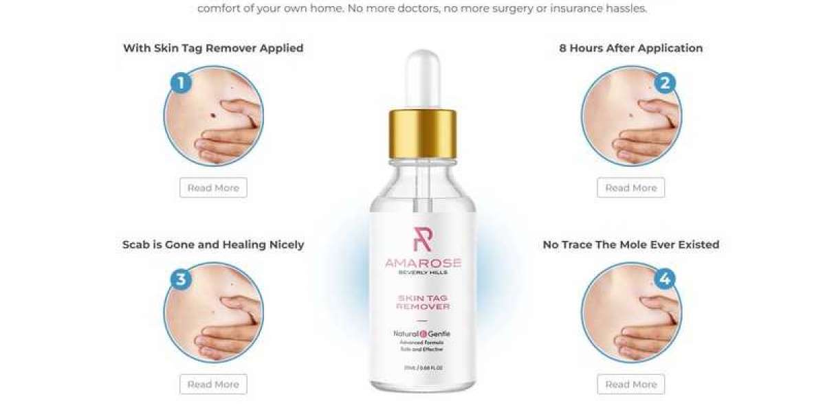 The Millionaire Guide On Amarose Skin Tag Remover Reviews To Help You Get Rich