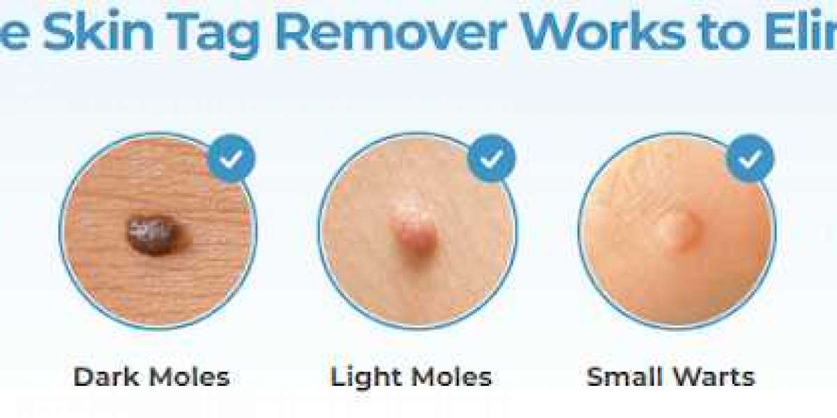 !Never Mess With Amarose Skin Tag Remover And Here's The Reasons Why